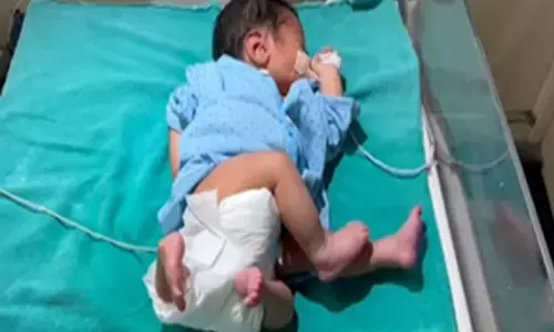 UP News: यहां हुआ 4 हाथ और 4 पैर वाले बच्‍चे का जन्म, डॉक्टरों ने इलाज शुरू किया