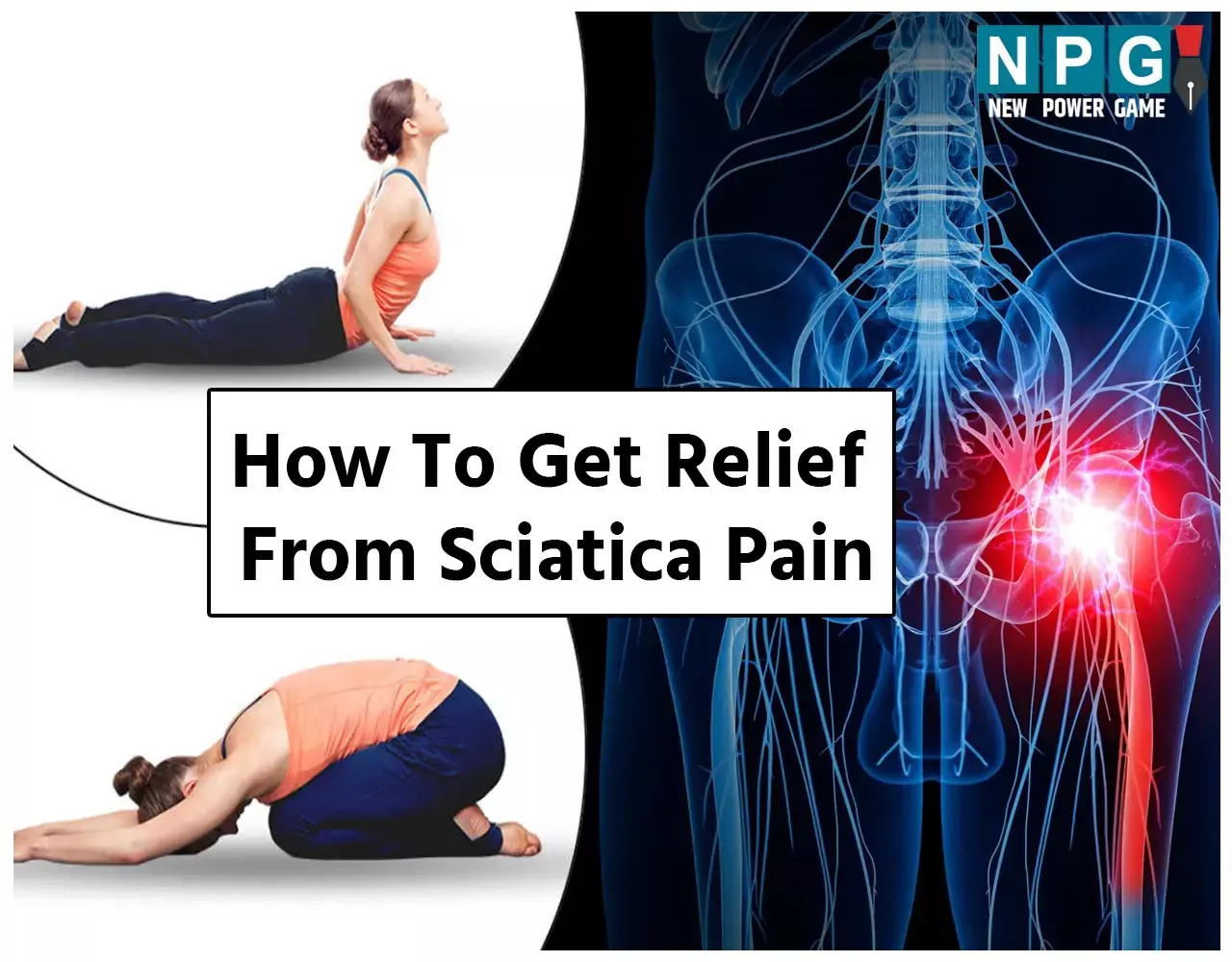 How To Get Relief From Sciatica Pain: आम समस्या नहीं, बल्कि साइटिका है बेहद पेनफुल, यहां पढ़िए ज़रूरी जानकारी और राहत के उपाय