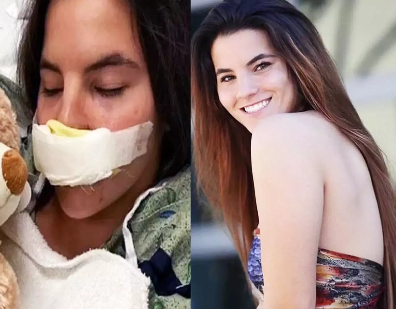 Model Brooklyn Khoury News: क्या आपको याद है ये खूबसूरत मॉडल? जिसका होंठ और नाक को काट खा गया पिटबुल...