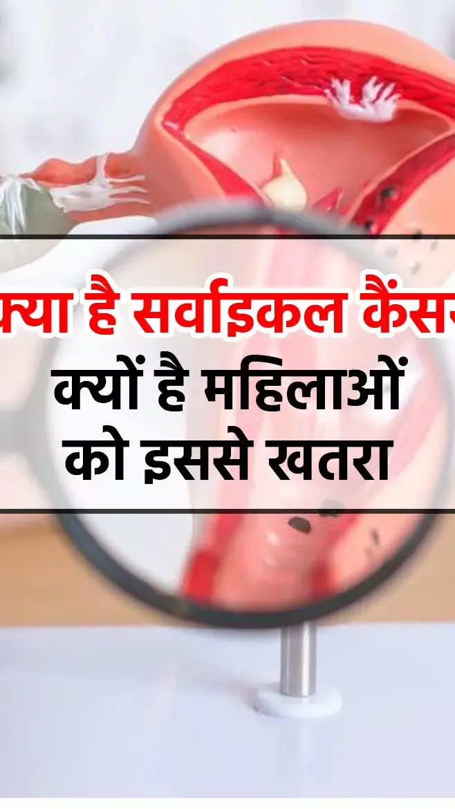 Cervical Cancer: क्या है सर्वाइकल कैंसर, क्यों है महिलाओं को इससे खतरा, जानिए इसका कारण...