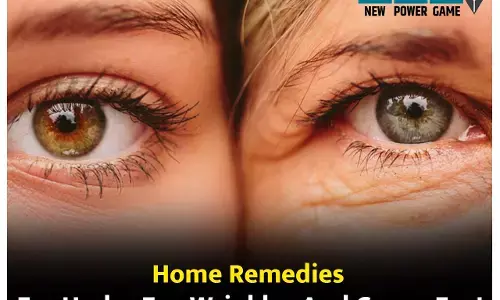 Home Remedies For Under Eye Wrinkles And Crows Feet: आंखों के किनारे नज़र आने लगी हैं कौए के पंजे जैसी झुर्रियां? अपनाकर देखें, इन घरेलू उपायों से ये जिद्दी झुर्रियां होंगी गायब...