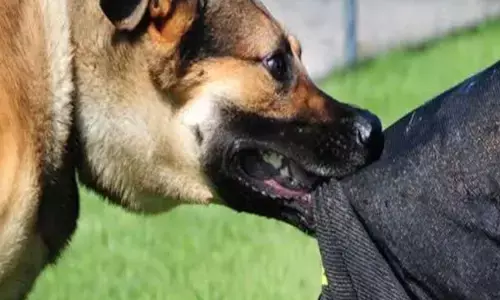 Bhopal News: पेरेंट्स बच्चों को न छोड़ें अकेला, फ़ैल रहा कुत्तों का आतंक, भोपाल में कुत्ते ने मासूम बच्चे पर किया हमला, जबड़ा नोंचा, खा गए दांत