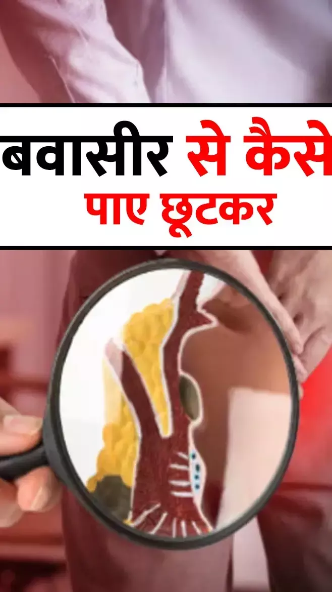 Bawaseer Ka Ilaj: क्या आप भी है बवासीर के मरीज, तो भूलकर भी न खाएं ये चीज़ें...