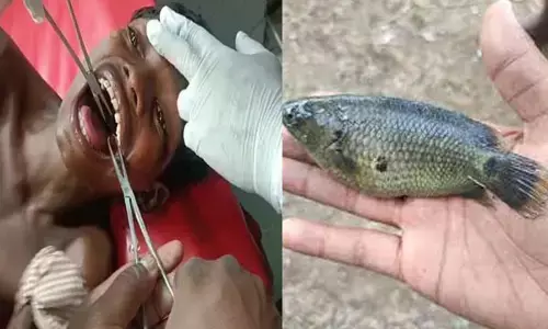 Janjgir Champa: बच्चे के मुंह में फंसी जिंदा मछली, तालाब में मछली पकड़कर मुंह में दबाया, उछलकर गले में फंसी...जाने फिर क्या हुआ