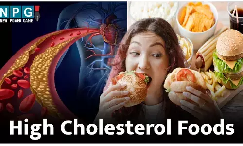 High Cholesterol Foods: कोलेस्ट्रोल घटाना है तो खाने की इन चीज़ों से कर लें तौबा, वरना खुद बनेंगे हार्ट हेल्थ के दुश्मन...