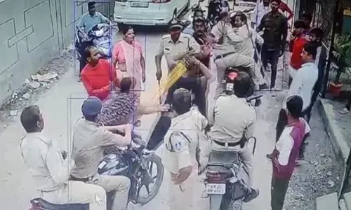 Indore News: विधायक के समर्थकों ने कैफे कर्मचारी को पीटा, फोड़ा सिर, खड़े होकर देखती रही पुलिस, अधिकारियों ने कहा समझौता कर लो