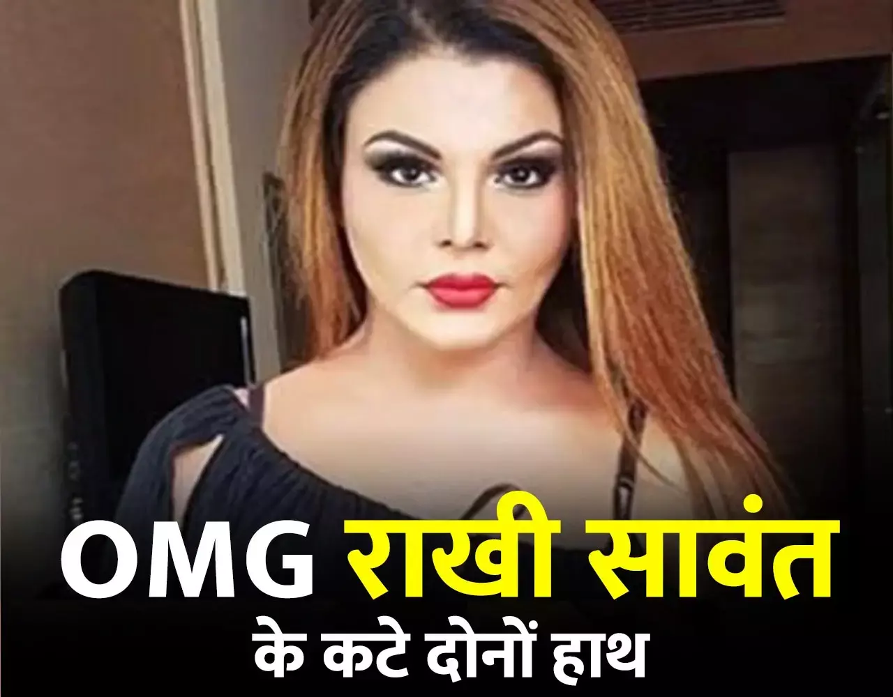 Rakhi Sawant News: राखी सावंत के कट गए दोनों हाथ... बॉलीवुड ड्रामा क्वीन ने इंस्टा पर वीडियो किया शेयर, फैंस में मची खलबली...