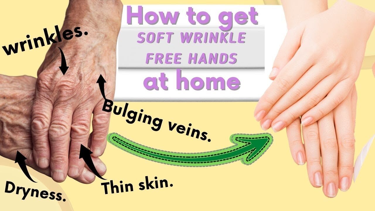 Home Remedies for Hands Wrinkles