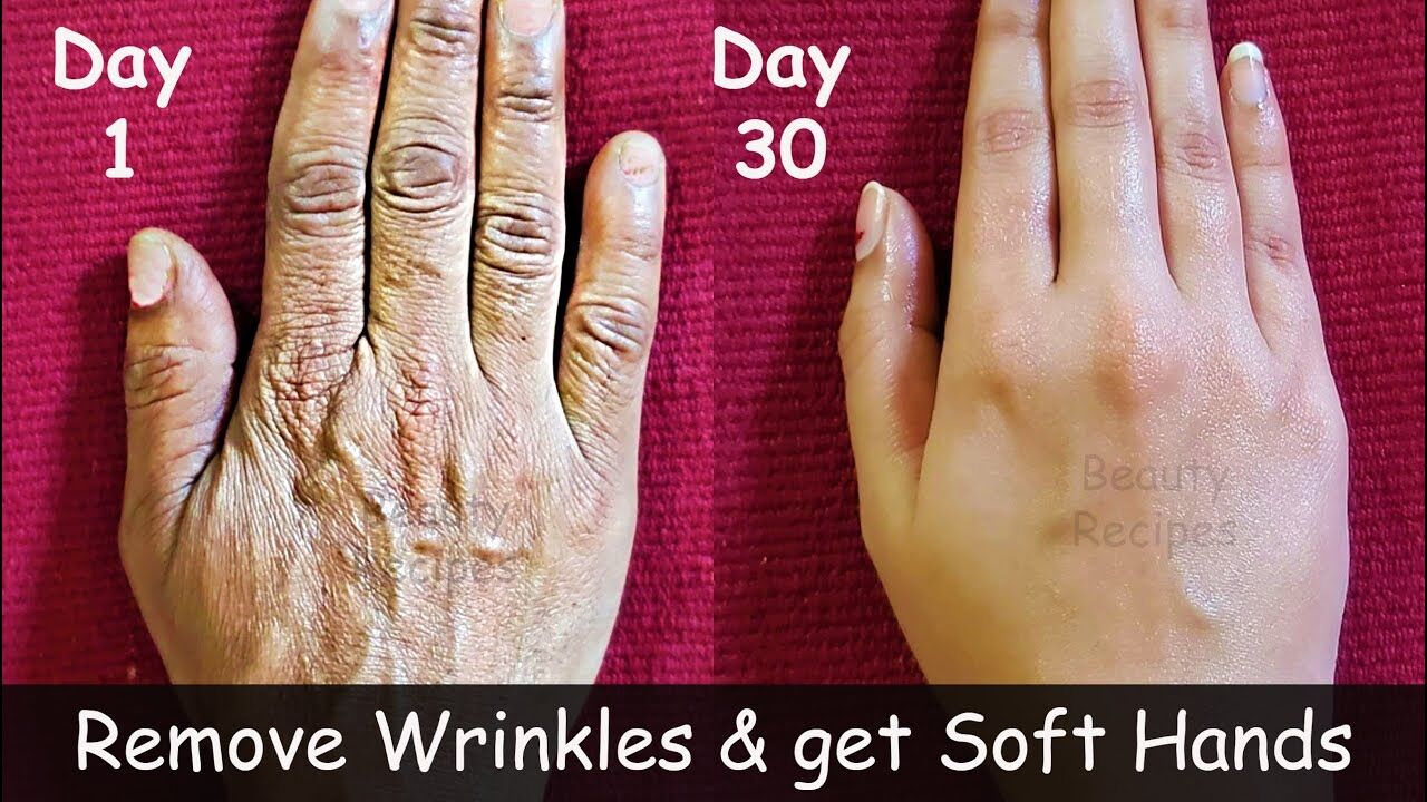 Home Remedies for Hands Wrinkles