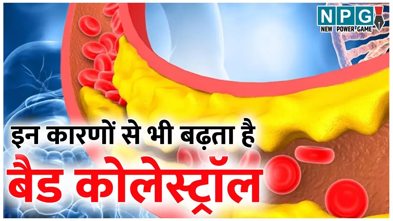 Causes Of High Cholesterol: तली हुई चीज़ें ज्यादा खाने से ही नहीं, इन कारणों से भी बढ़ता है बैड कोलेस्ट्राॅल...
