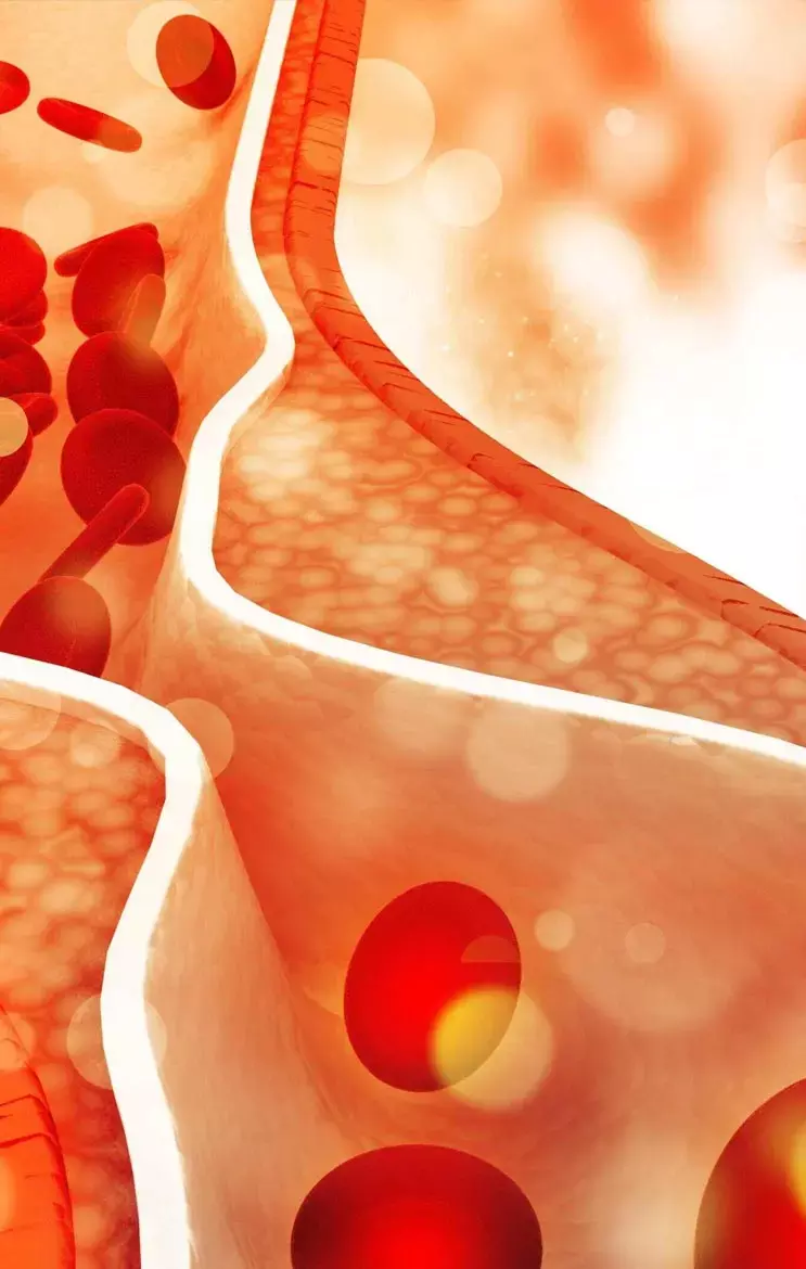 High Cholesterol Ke Karan: डीप फ्राइड आइटम्स से हैं दूर? फिर भी इन कारणों से बढ़ सकता है कोलेस्ट्रॉल...