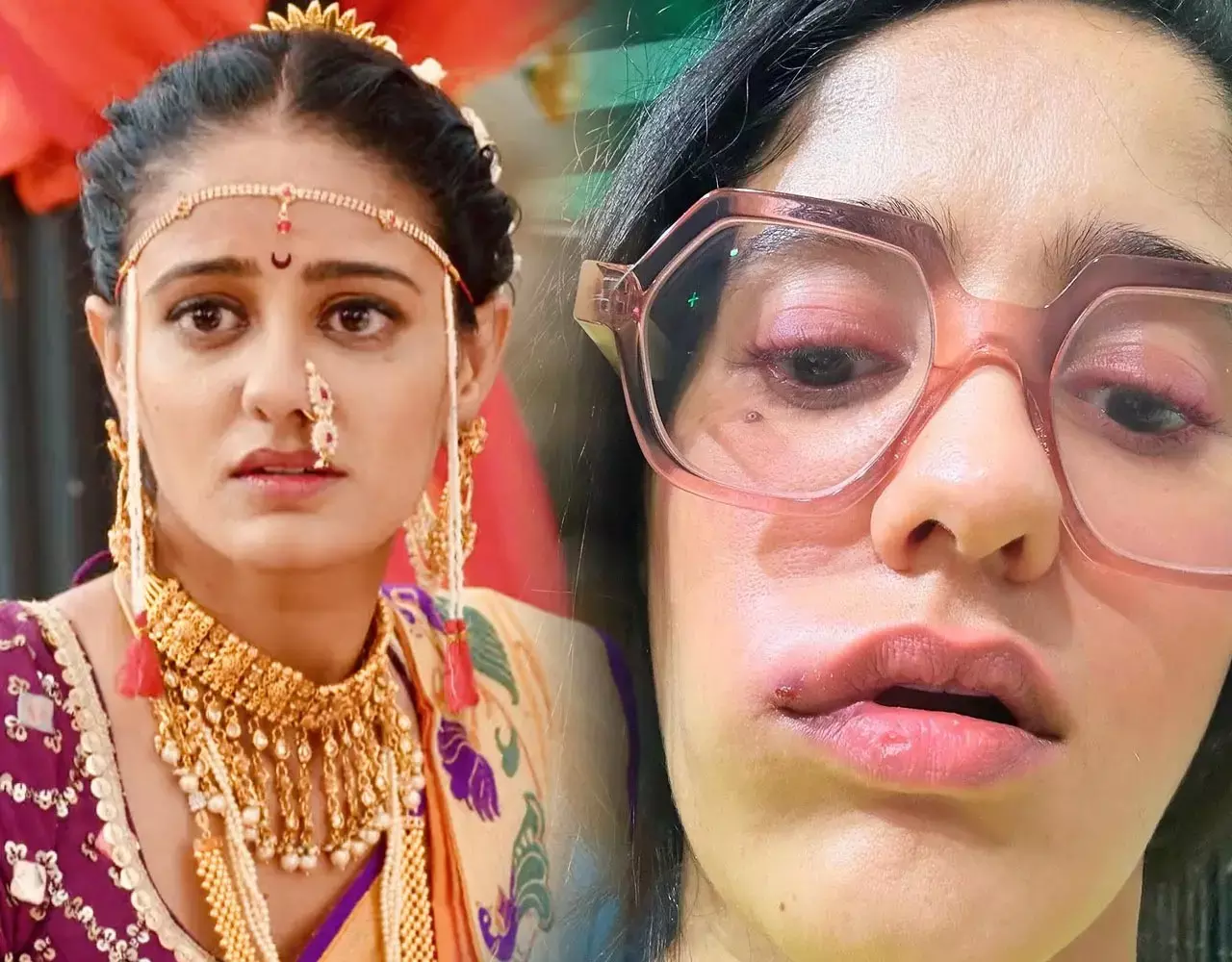 Ayesha Singh News: बिगड़ा गुम है किसी के फेम की सई का चेहरा, फूले होंठ-सूजा चेहरा दर्द से परेशान दिखी एक्ट्रेस आयशा सिंह...