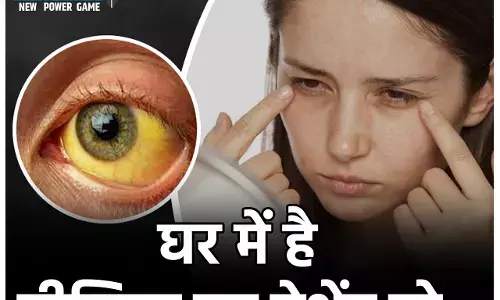 Jaundice Myths and Facts: घर में है पीलिया का पेशेंट तो न पड़ें इन मिथकों के फेर में, यहां जानिए एक्सपर्ट द्वारा बताए गए फैक्ट्स...