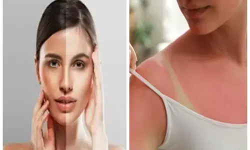 Sun Tanning: चिलचिलाती धूप और सन टैनिंग.. ये घरेलू उपाय कर देखें, डार्कनेस खत्म होकर स्किन करने लगेगी ग्लो