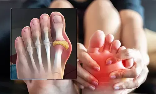 Foods To Avoid With High Uric Acid: ये सात चीज़ें हैं बढ़े हुए यूरिक एसिड के दौरान ज़हर समान, जोड़ों के दर्द को बना देंगी असहनीय...