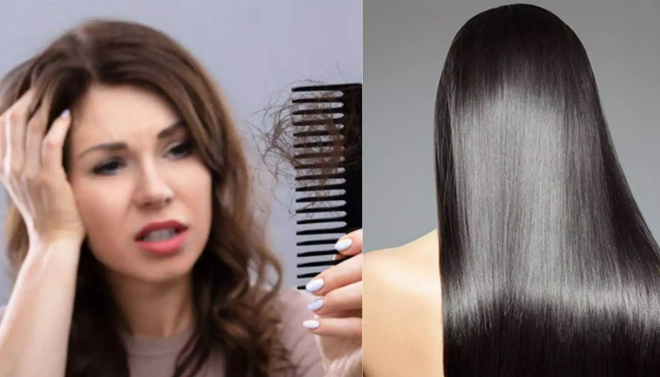 Hair loss cause : किन विटामिन्स की कमी से बालों का झड़ना होता है शुरू? जानिए कारण और घरेलु नुस्खे