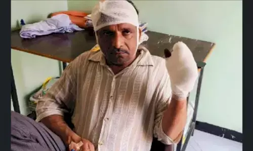 Guna Crime News: गुना में दबंगों ने काटी किसान की उंगलियां, बेटे की हत्या के मामले को रफा-दफा करने का बना रहे थे दबाव