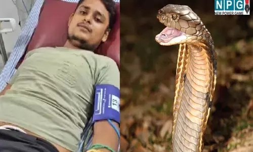 Fatehpur Snake Bite Case: युवक की जान का दुश्मन बना सांप! 40 दिनों में 7वीं बार डसा, नौवीं बार में होगी मौत... CMO ने दिया ये आदेश