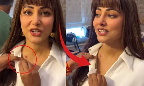 Hina Khan Cancer Video: शूटिंग में कैंसर से पीड़ित हिना खान पहुंची नकली बाल लगाकर, कपड़ों से छिपाए शरीर के निशान, देखिए...