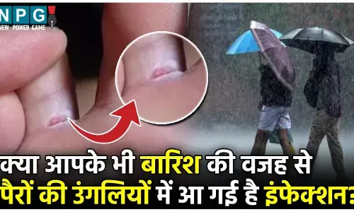 Home Remedies For Foot finger fungal infection: बारिश के मौसम में नमी से पैरों की उंगलियों के बीच हो गया इंफेक्शन? दर्द और तकलीफ़ से राहत देंगे ये घरेलू नुस्खे...