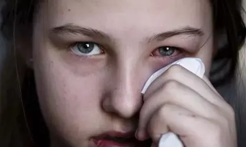 Eye infections in Mansoon : मानसून में तेजी से बढ रहा Eye infections... इनका रखें ध्यान