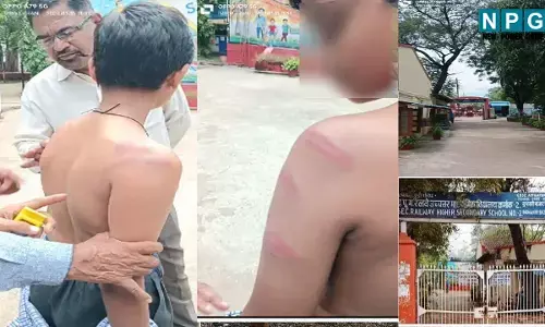 Bilaspur News: स्टूडेंट की बेरहमी से पिटाई, शिक्षक सस्पेंड, जानिए क्या है पूरा मामला...