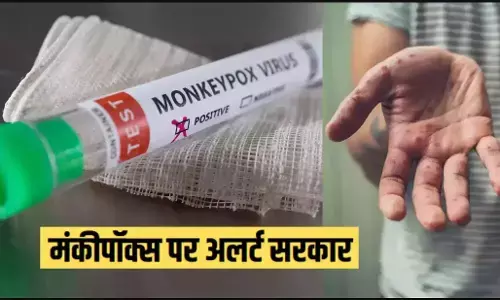 Monkeypox cases in India: कोरोना के बाद मंकीपॉक्स का कहर, भारत में मंकीपॉक्स को लेकर अलर्ट, बॉर्डर और एयरपोर्ट पर शुरू हुई निगरानी