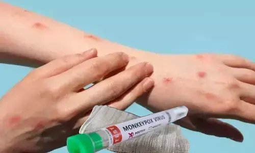 Monkey Pox second case: दिल्ली के बाद केरल में सामने आया मंकीपॉक्स का मामला, स्वास्थ्य विभाग हुआ अलर्ट