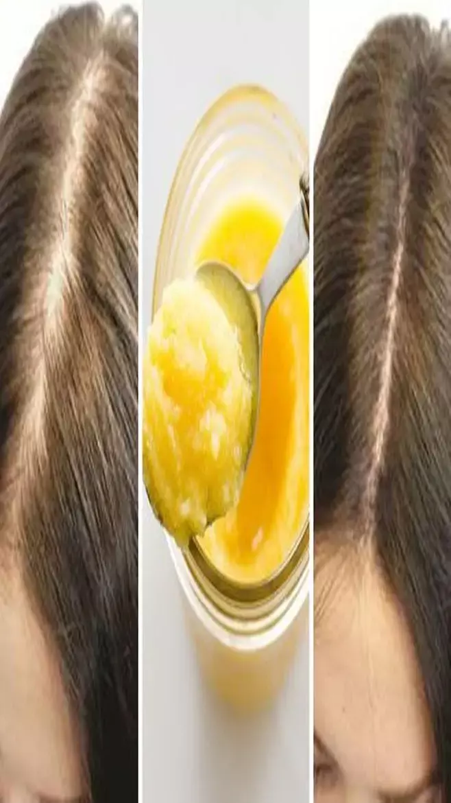 Balon Mein Ghee Lagane Ke Fayde: बालों के लिए फायदेमंद है घी, झड़ने से लेकर हर तरह की...