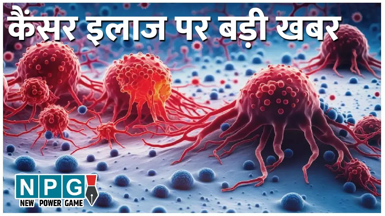 Cancer Rajasthan News: कैंसर इलाज पर बड़ी खबर: अब एक झटके में ट्यूमर का मिटेगा नामोनिशान, फ्री में होगी इलाज! जानिए....