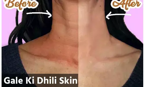 Gale Ki Dhili Skin Kaise Tight Kare: गले की स्किन होती है सबसे पहले लूज़, महिलाएं इस होम रेमेडी से करें टाइट...