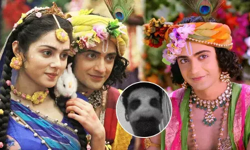 Sumedh Mudgalkar Fracture: राधाकृष्ण फेम के कृष्ण मुरली के साथ भयंकर हादसा, टूट गई एक्टर सुमेध की नाक की हड्डी, देखिए...