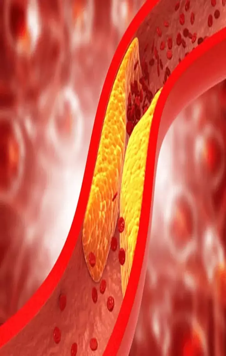 How To Unblock Arteries: इस जूस की एक चम्मच रोज़ लेने से खुल जाएंगी ब्लाॅक होती आर्टरीज़, हार्ट डिसीज़ का टलेगा खतरा