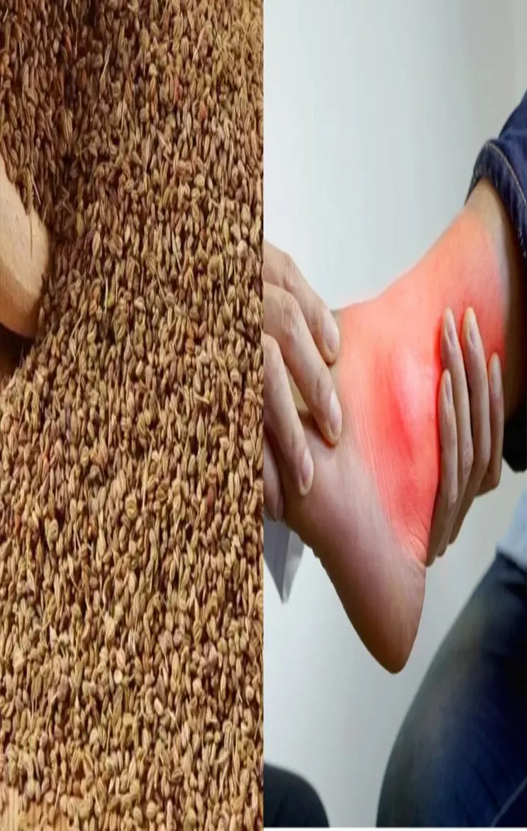 Ajwain For Uric Acid: अजवाइन के छोटे-छोटे दाने हैं यूरिक एसिड के दुश्मन, गठिया से राहत के लिए जाने कैसे करें इस्तेमाल