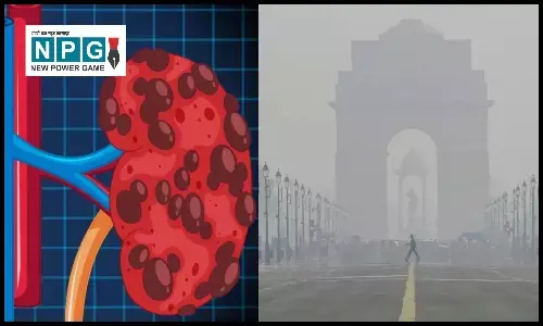 Delhi-NCR: प्रदूषण के कहर से बचने का वक्त या शहर छोड़ने का?