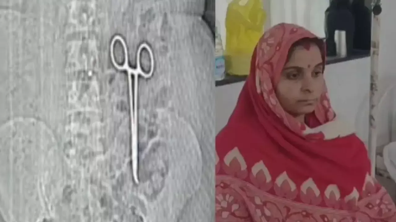 Bhind Hospital News: पेट के अंदर कैंची! महिला ने कराया सीटी स्कैन, तो सामने आई डॉक्टर की लापरवाही, जाने पूरा मामला