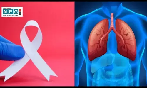 Health Update Cancer: अब यूरिन टेस्ट से फेफड़ों के कैंसर का पता जल्दी और आसानी से