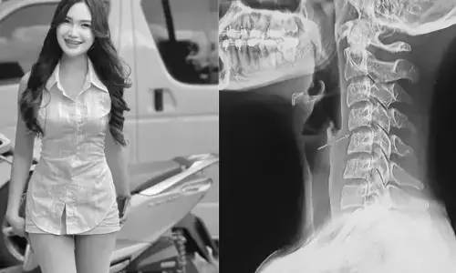 Ping Chayada Dies: मसाज के बाद पॉप सिंगर पिंग चायडा की मौत, जानें क्या है पूरा मामला?