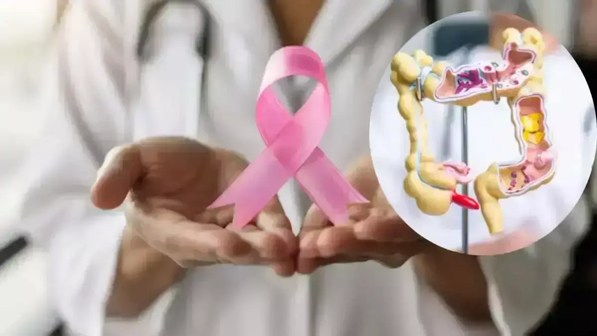 Cancer Symptoms: कोलन कैंसर के शुरुआती लक्षणों को नजरअंदाज न करें, जानें कैसे एक युवक ने पांच साल पहले इसे पहचाना