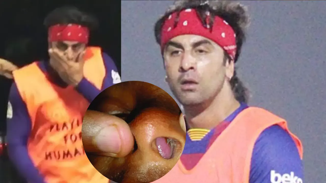 Ranbir Kapoor Has Deviated Nasal Septum: रणबीर कपूर की दुर्लभ बीमारी: नाक की समस्या ने किया उनके जीवन को प्रभावित, जानिए क्या है नेजल डेविएटेड सेप्टम Ranbir Kapoor Has Deviated Nasal Septum: रणबीर कपूर की दुर्लभ बीमारी: नाक की समस्या ने किया उनके जीवन को प्रभावित, जानिए क्या है नेजल डेविएटेड सेप्टम