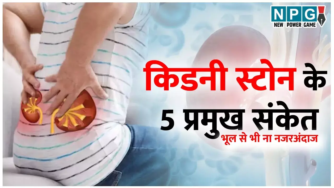 Kidney Stone Symptoms: किडनी स्टोन के 5 प्रमुख संकेत, जिन्हें नजरअंदाज करना हो सकता है खतरनाक!...