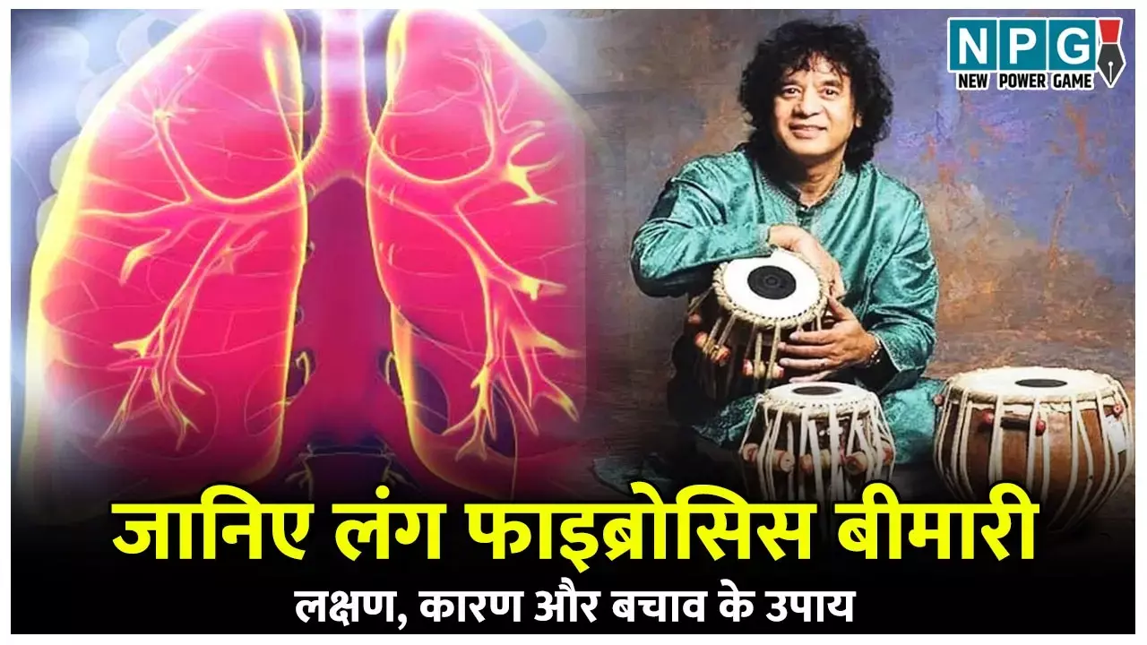 Zakir Husain Death: तबलावादक जाकिर हुसैन की मौत: जानिए लंग फाइब्रोसिस बीमारी के लक्षण, कारण और बचाव के उपाय...