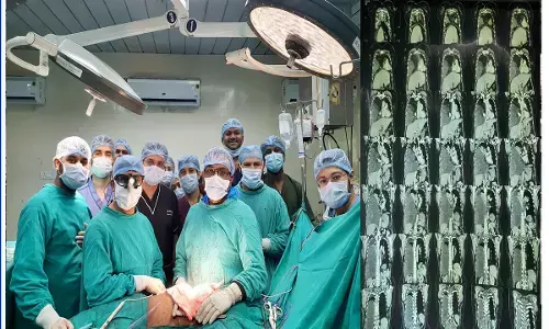 CG: अम्बेडकर अस्पताल के डॉक्टरों ने रचा इतिहास, निकाला फेफड़े और हार्ट से चिपका पांच किलो का ट्यूमर...