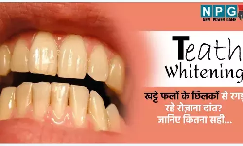 Teath Whitening: क्या आप भी खट्टे फलों के छिलकों से रगड़ रहे रोज़ाना दांत? दांत चमकाने का यह तरीका कितना सही? जानिए डॉक्टर की सलाह...