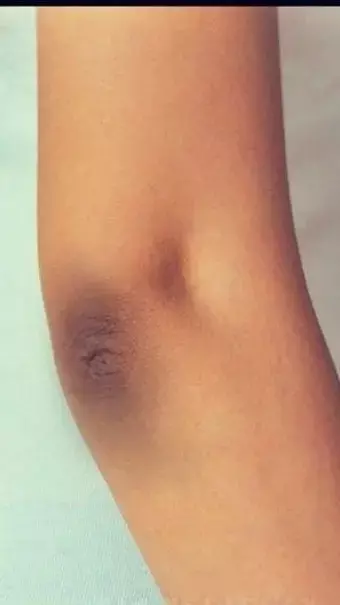 Kohniyo Aur Ghutno Ka kalapan Kaise Door Karain: सर्दियों में बढ़ गया है कोहनियों और घुटनों का कालापन? ये घरेलू नुस्खे आएंगे काम