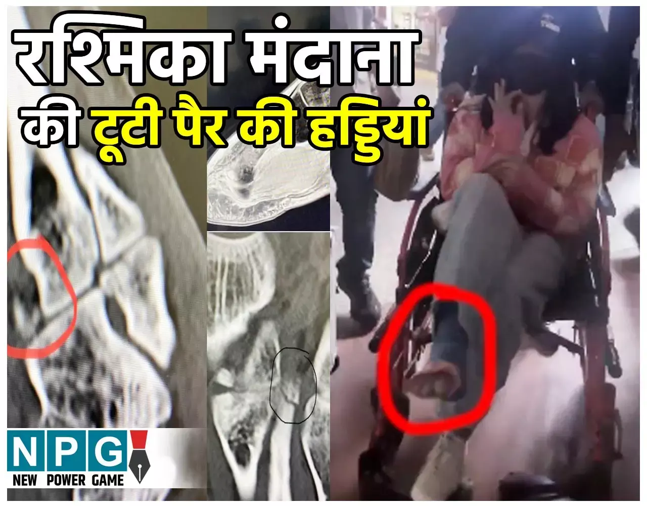 Rashmika Mandanna News: रश्मिका मंदाना की टूटी पैर की हड्डियां, दर्द में तड़पती हुई दिखी एक्ट्रेस, देखिए फोटो-वीडियो... Rashmika Mandanna News: रश्मिका मंदाना की टूटी पैर की हड्डियां, दर्द में तड़पती हुई दिखी एक्ट्रेस, देखिए फोटो-वीडियो...