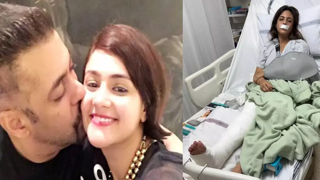 Shweta Rohira Accident: सलमान खान की बहन का भयानक एक्सिडेंट, पट्टी होंठ, टूटी हाथ-पाँव, सामने आया दहल देने वाला तस्वीर...