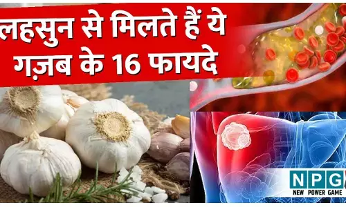 Lahsun Khane Ke 16 Fayde: यूं ही नहीं कहलाता लहसुन वंडर हर्ब, रोज़ाना महज दो कलियों के सेवन से मिलते हैं गज़ब के ये 16 फायदे...