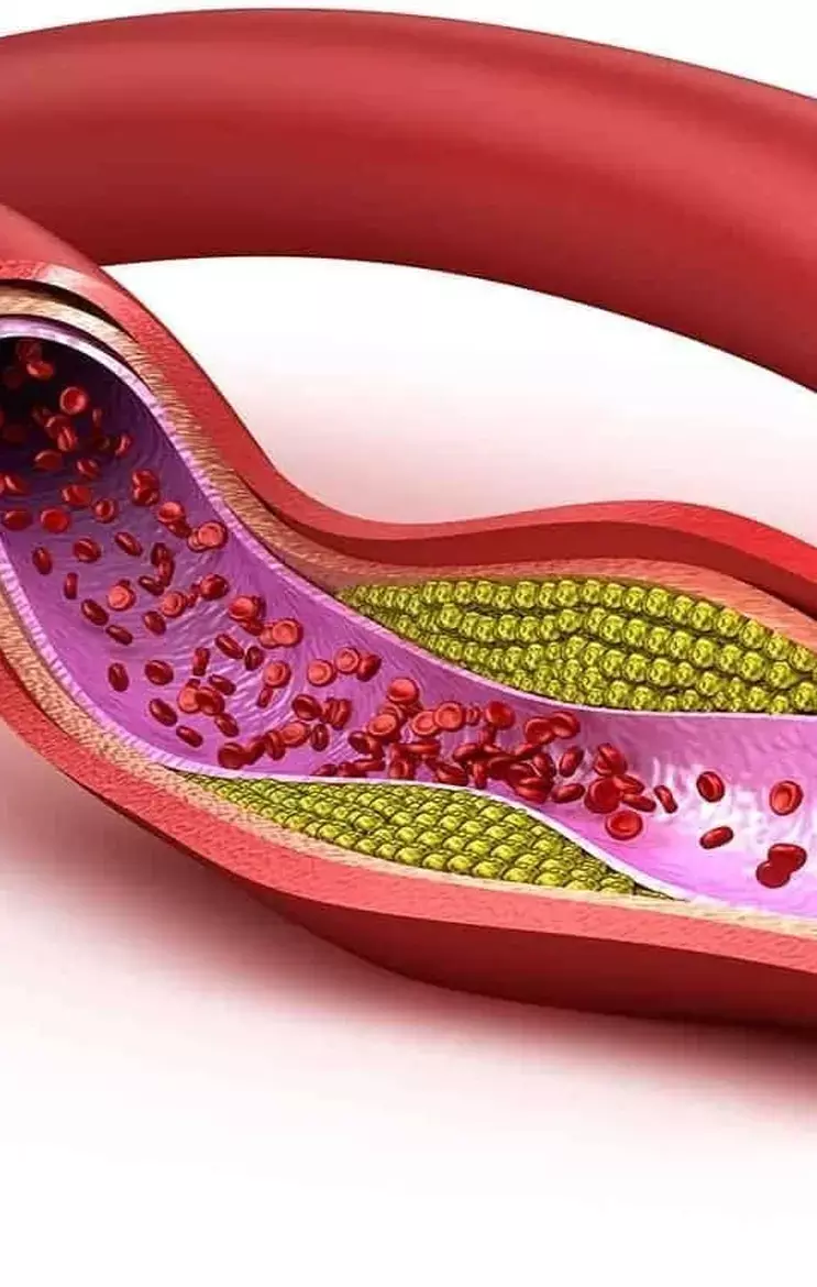 Health Benefits Of Pomegranate: अनार नहीं होने देगा बीमार, जानिए अच्छे स्वास्थ्य के लिए अनार के फायदे