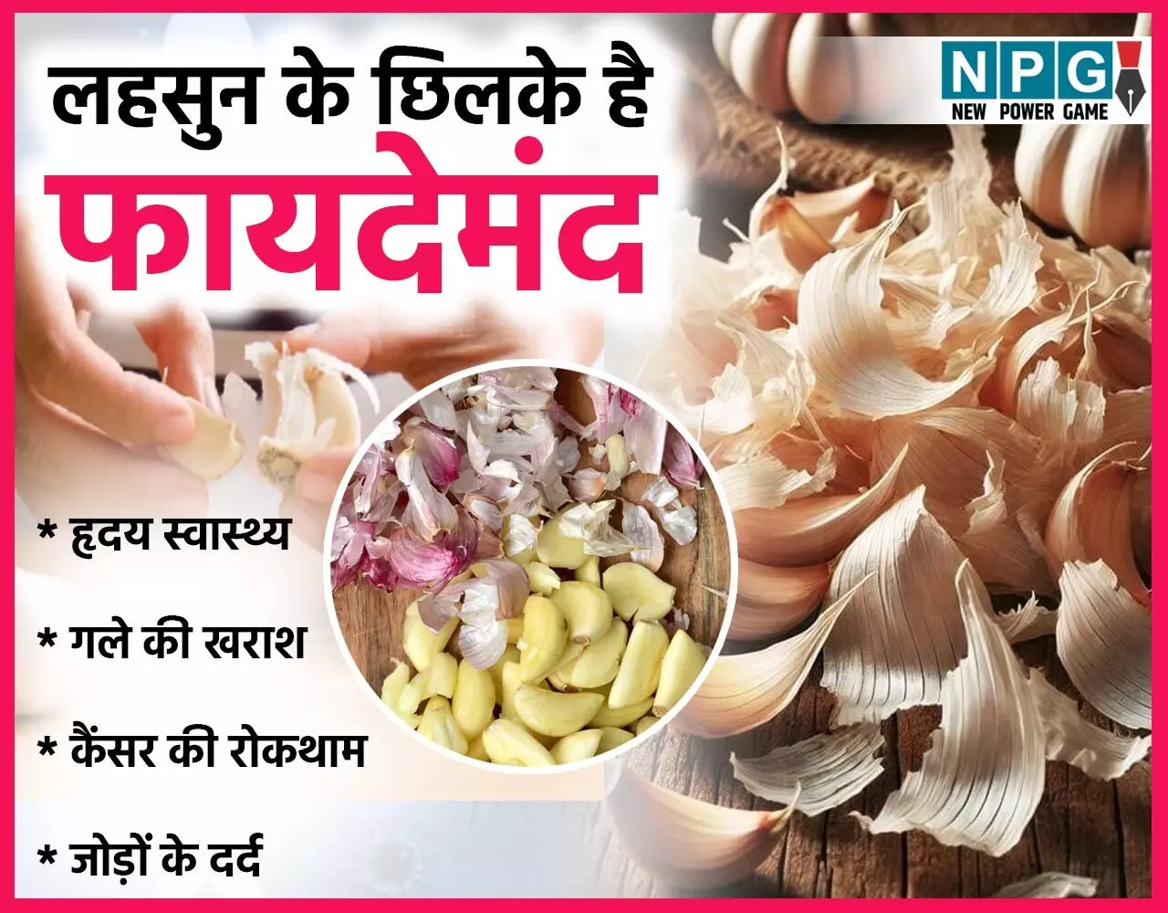 Garlic Peels Benefits And Uses: मत फेंकिए लहसुन के छिलके, ये है बेहद फायदेमंद